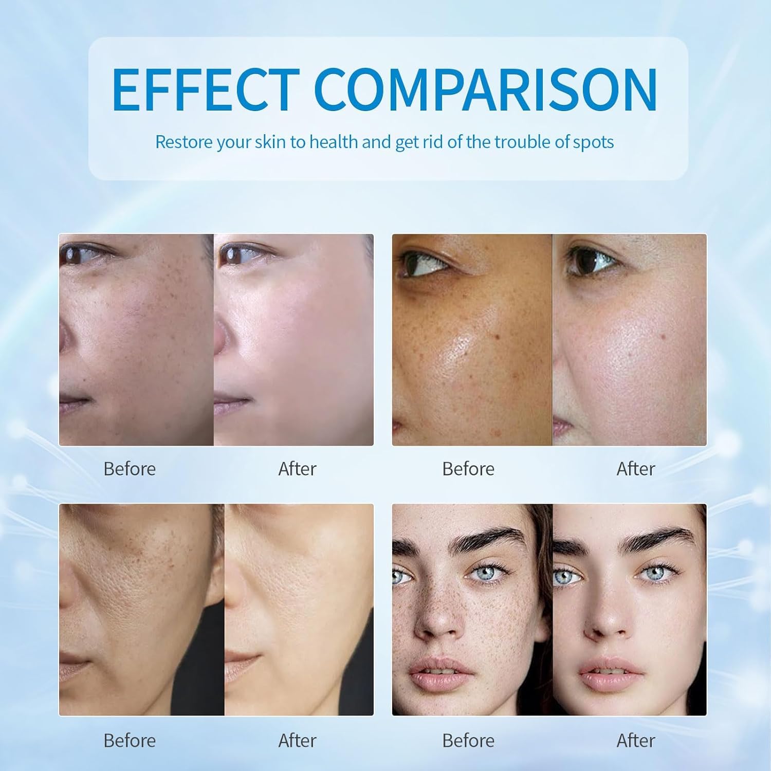 Dark Spot Remover for Face. Dark Spot Corrector. Dark Spot Serum for Sun Spots. Age Spots. Brown Spots.Acne Scars.Melasma Brown Spot -Advanced Formula with Niacinamide Vitamin C (1 Fl Oz (Pack of 1) : Everything Else