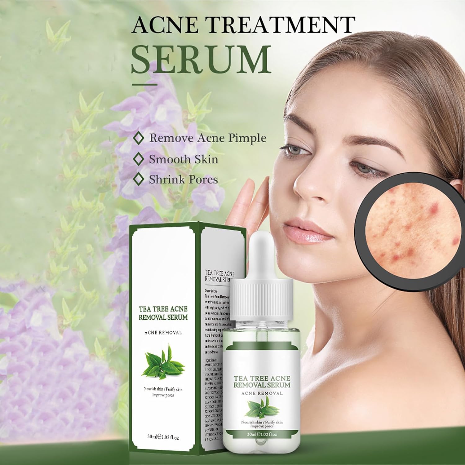 Acne Removing Facial Serum.Natural Ingredients Professionally Remove Acne Marks.For Teens & Adults Anti-acne Moisturizer Acne Removal Serum : Beauty & Personal Care