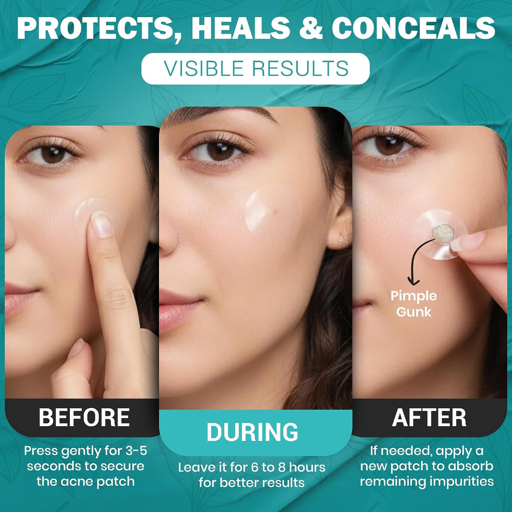 Mubo Care Pimple Patch – Hydrocolloid Acne Dots for Face. Invisible and Waterproof Blemish Spot Treatment – Fast Healing Pimple Stickers for All Skin Types