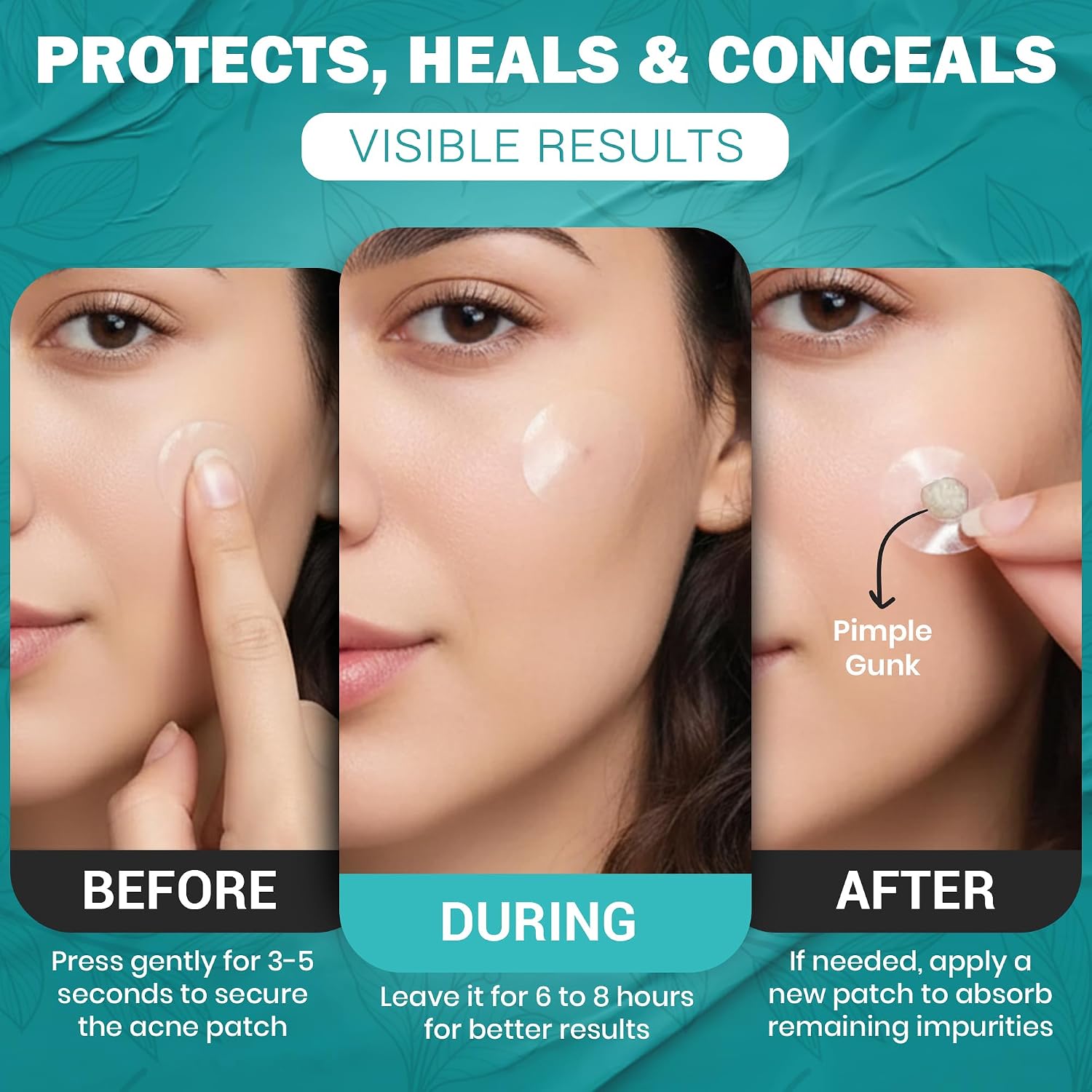 Mubo Care Pimple Patch – Hydrocolloid Acne Dots for Face. Invisible and Waterproof Blemish Spot Treatment – Fast Healing Pimple Stickers for All Skin Types