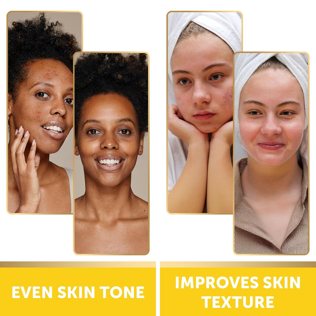 Turmeric Kojic Acid Cleansing Pads - Exfoliating Dark Spot Remover for Face with Vitamin C. Alpha Arbutin. Niacinamide and Retinol - Kojic Acid And Turmeric Cleansing Pads - 60 Units : Beauty & Personal Care