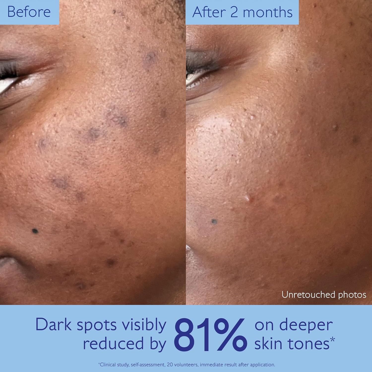 Caudalie Vinoperfect Brightening Dark Spot Serum Vitamin C Alternative - 62x More Effective than Vitamin C with Viniferine for a Visibly Brighter Even Complexion. 30 mL