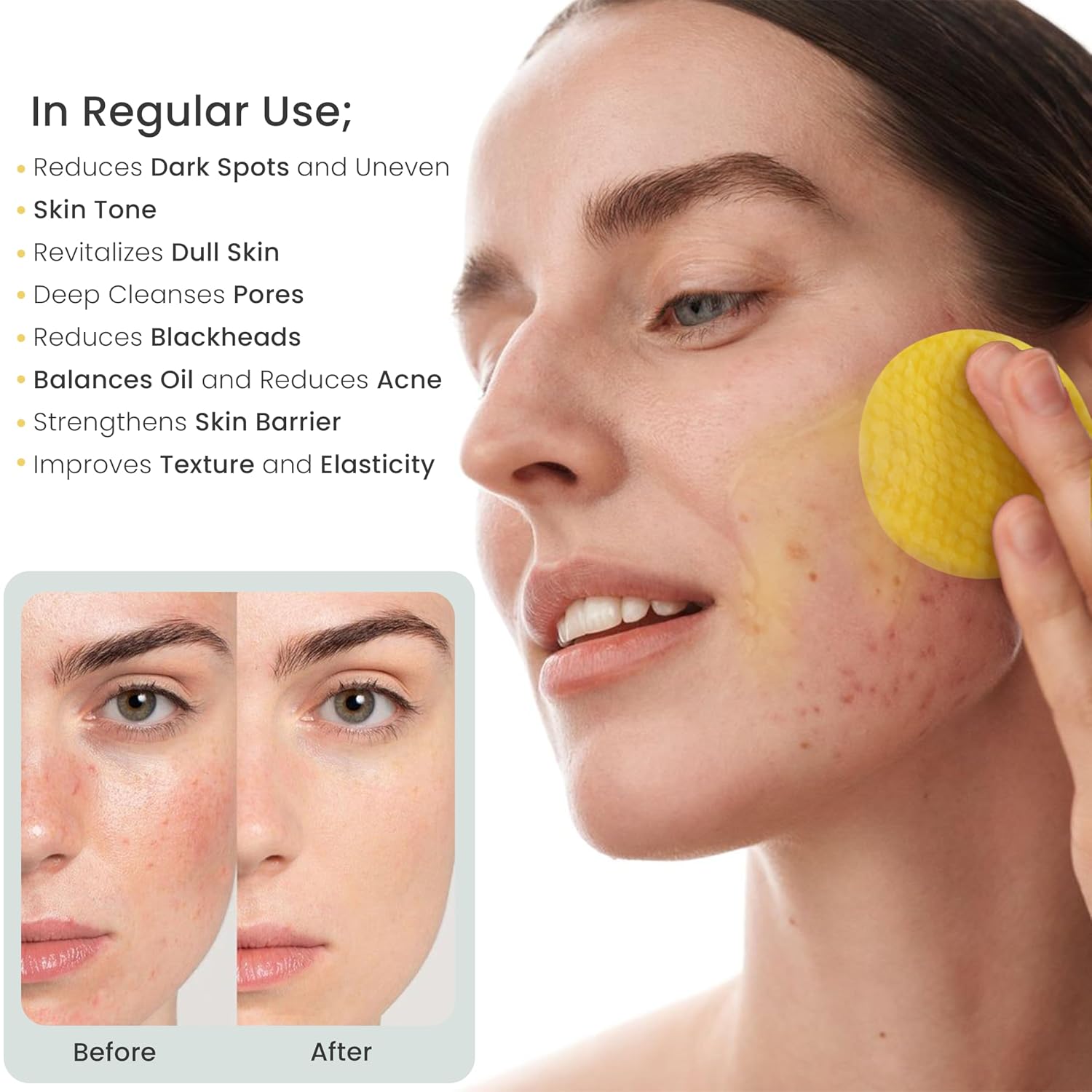 Kojic Acid & Turmeric Facial Cleansing Pads. 50 Count. Vitamin C. Gentle Exfoliating Cotton Pads for Brighter & Refreshed Looking Skin. Daily Facial Cleansing Pads : Beauty & Personal Care
