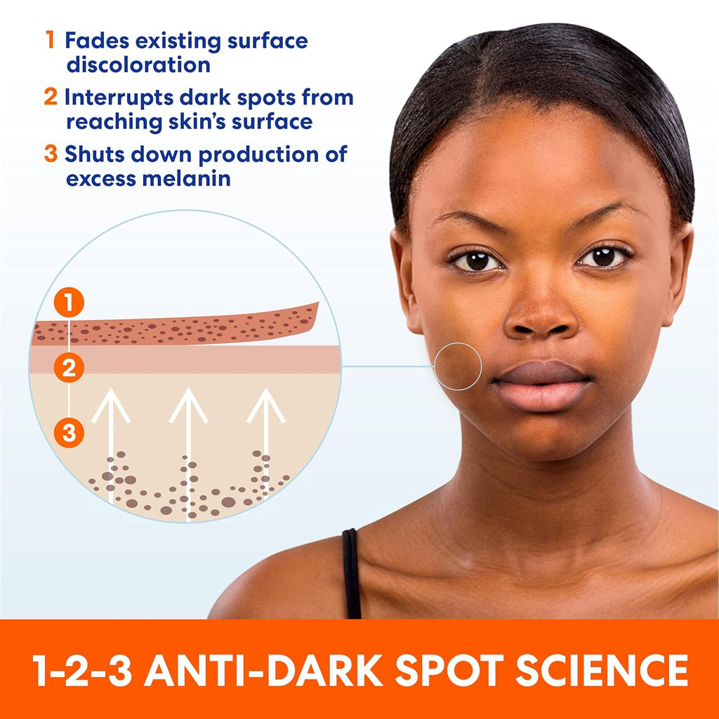 Palmer's Skin Success Anti-Dark Spot Fade Cream with Vitamin E and Niacinamide. for All Skin Types 2.7 Ounce : Beauty & Personal Care