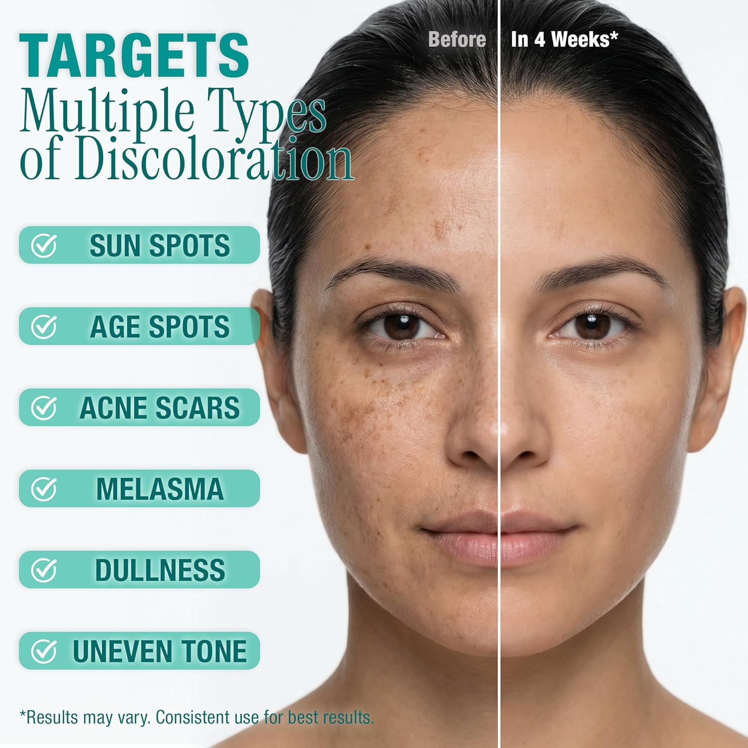 Ebanel Dark Spot Remover for Face & Body. Brightening Serum with Synovea HR. Alpha Arbutin. Niacinamide. Kojic Acid. Dark Spot Corrector for Hyperpigmentation. Discoloration. Melasma and Age Spots