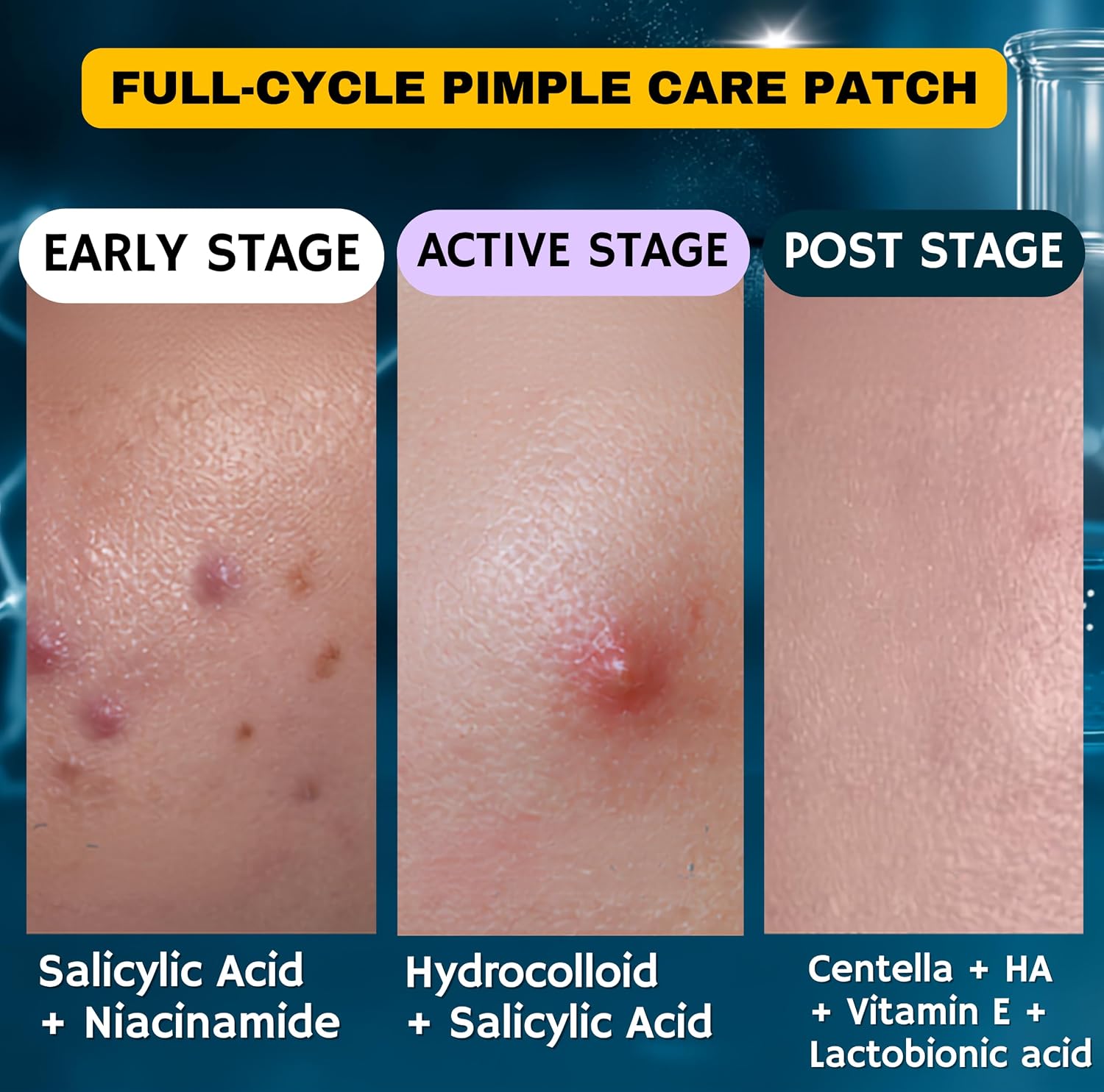 SEEDRAFOX Super Pimple Patch for Acne & Pimples | Hydrocolloid Acne Patch with Salicylic Acid & Niacinamide | Invisible Pimple Spot Patch | Ultra Thin Invisible Patches for Face | 108 Patches : Beauty & Personal Care