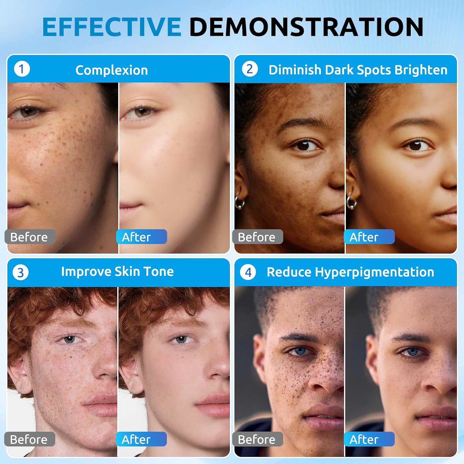 HANYWIL Dark Spot Remover for Face & Body Serum.Dark Spot Corrector Serum for Hyperpigmentation.Treatment for Sun Spots. Age Spots. Melasma. Dermatologist-Tested Skin Tone Evenser (2.0 Fl Oz) : Beauty & Personal Care