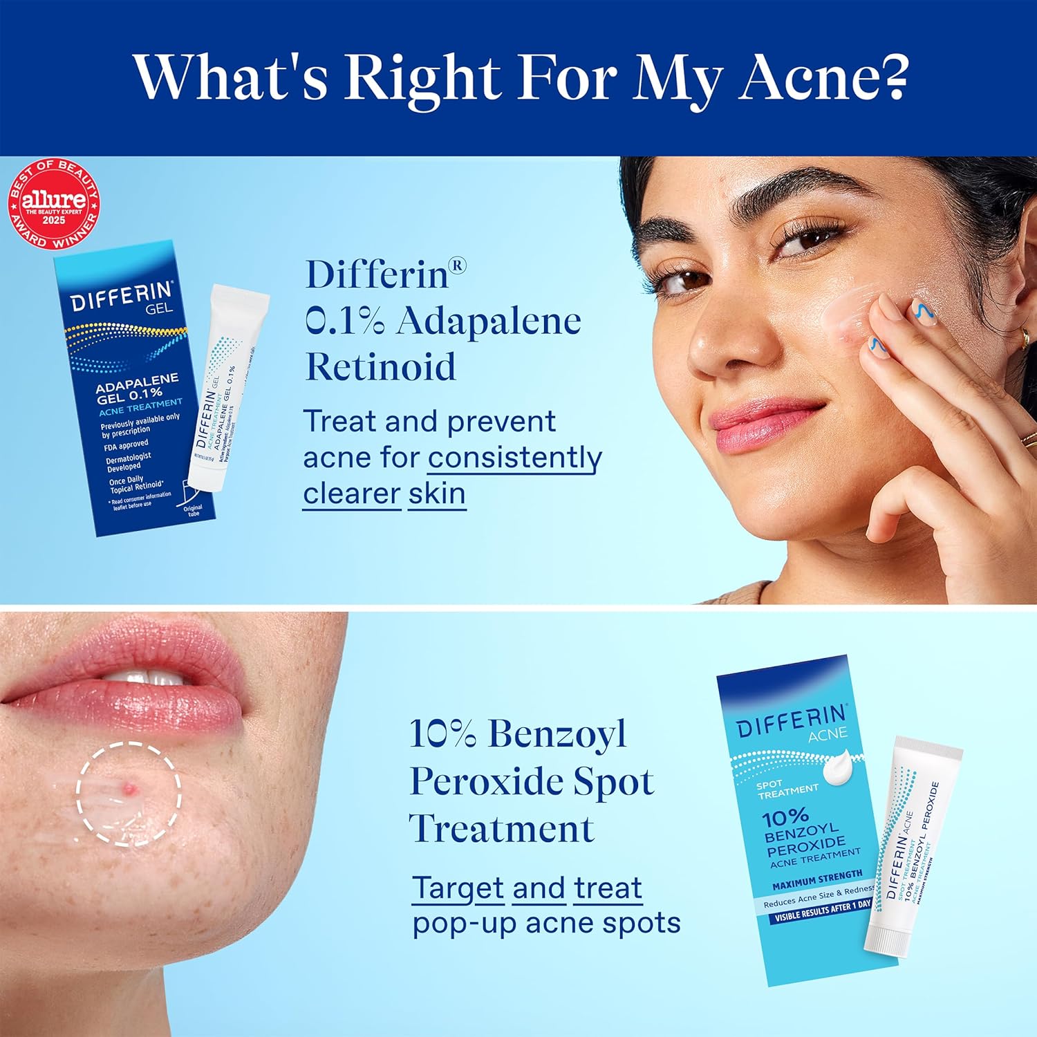 Differin Acne Spot Treatment with 10% Benzoyl Peroxide. Maximum Strength OTC Acne Treatment. Fast Acting Spot Treatment for Face. 1 oz : Beauty & Personal Care