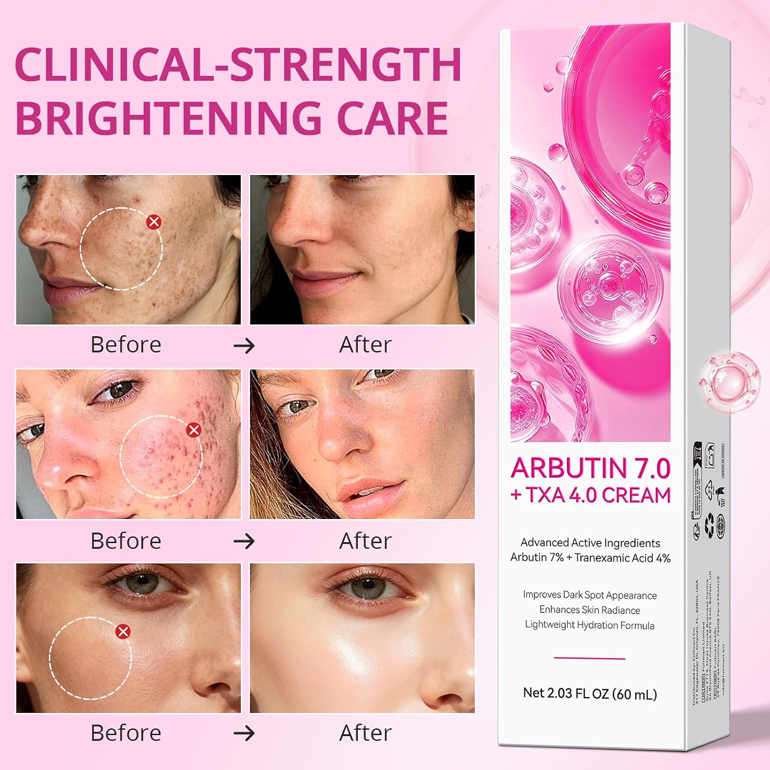Arbutin Cream. Advanced Active Ingredients. Dark Spots. Blemishes. Pigmentation. Dullness. Improves Dark Spot Appearance. Enhances Skin Radiance. Lightweight Hydration Formula - 2.03 fl oz (60 mL) : Beauty & Personal Care