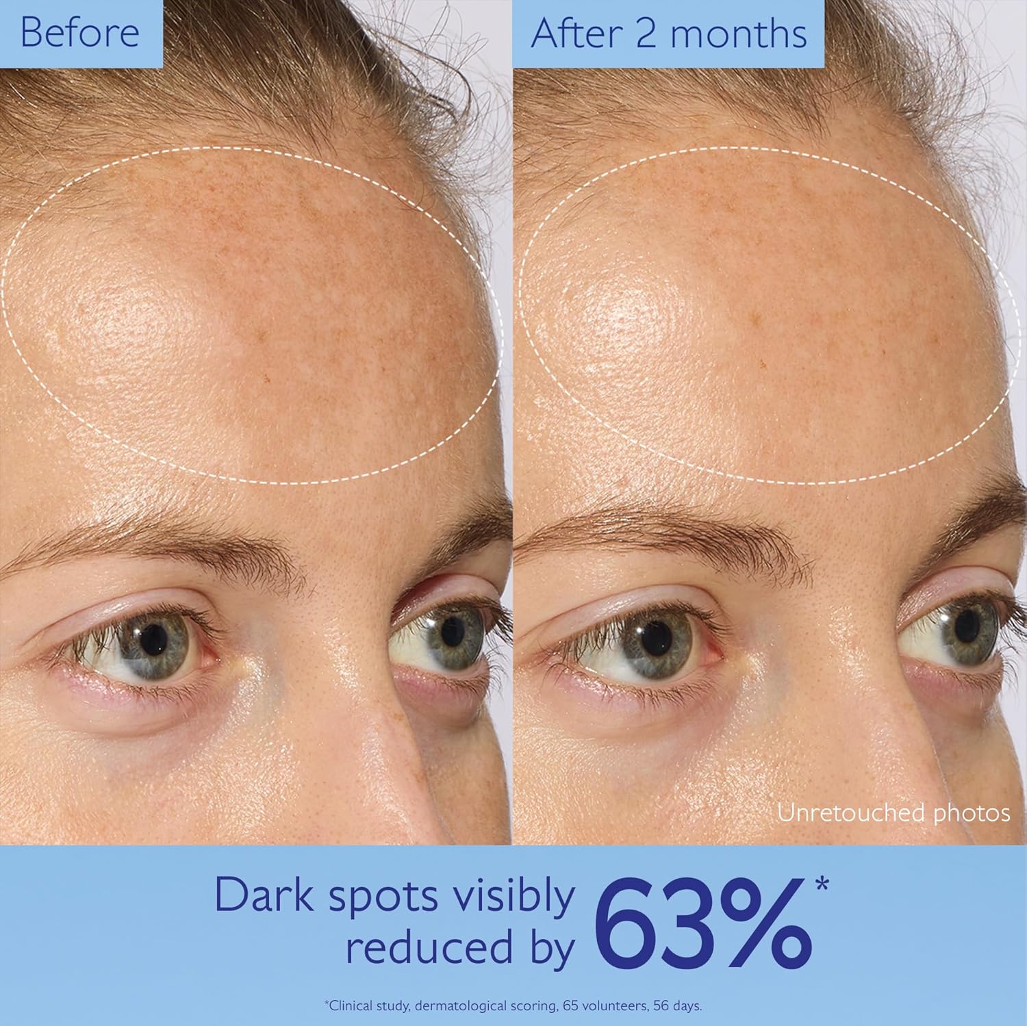 Caudalie Vinoperfect Brightening Dark Spot Serum Vitamin C Alternative - 62x More Effective than Vitamin C with Viniferine for a Visibly Brighter Even Complexion. 30 mL