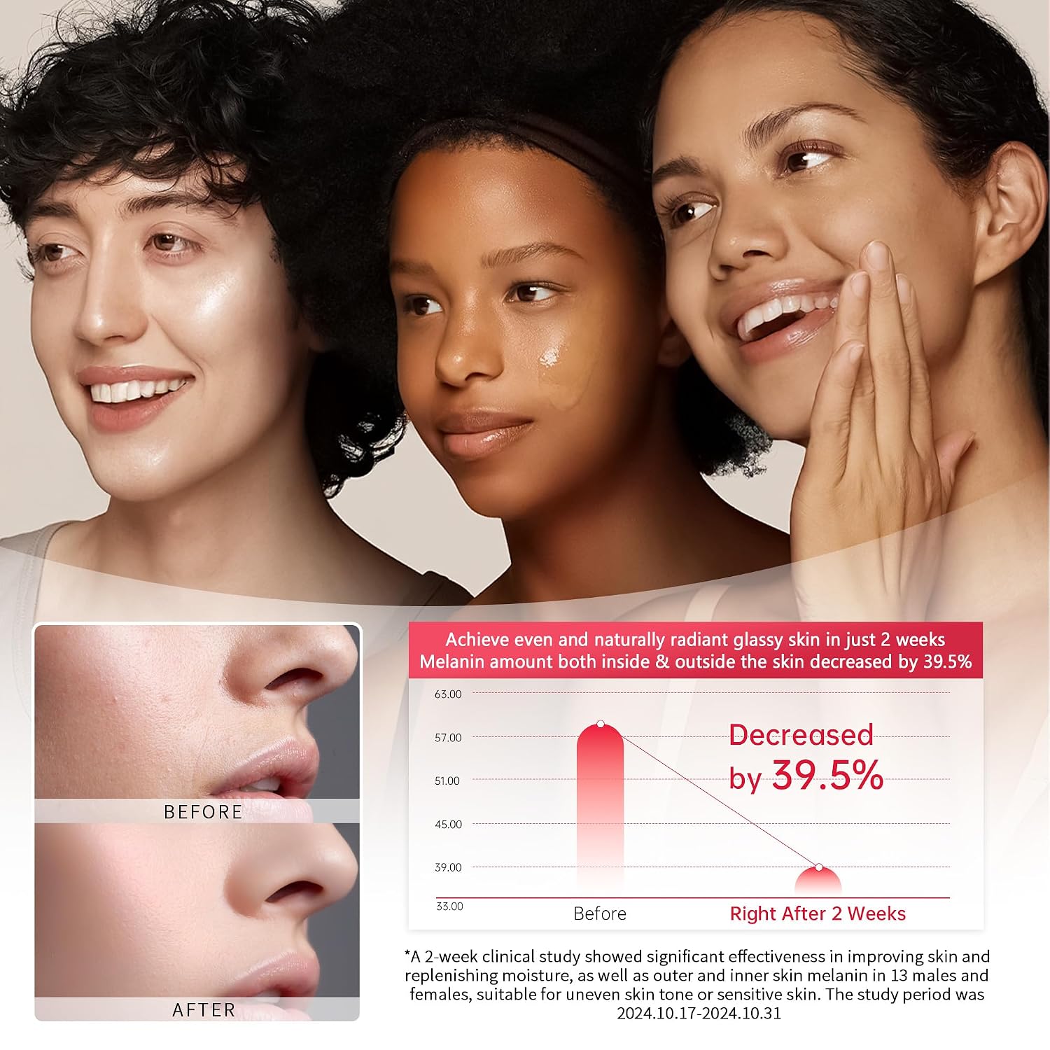 Alpha Arbutin 2% Serum for Dark Spots. Acne Scars. Pore Minimizer. Hydration & Removing Pigmentation - Hyaluronic Acid Serum. 1 Pcs 30 ML