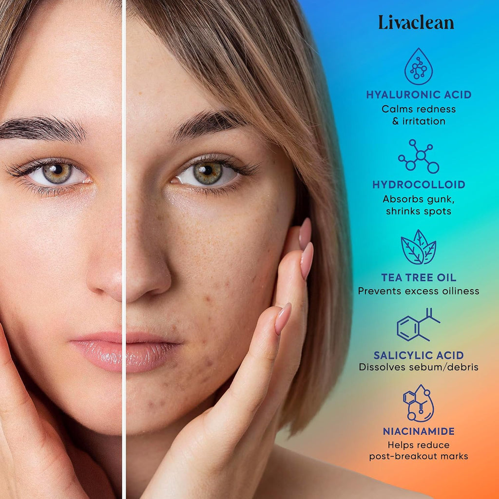 LivaClean 18 CT Microdart Acne Patch – Pimple Patches with Salicylic Acid & Tea Tree Oil – Dark Spot Patches for Face. Blemish Dots. Deep Pimple Patch. Salicylic and Hyaluronic Acid